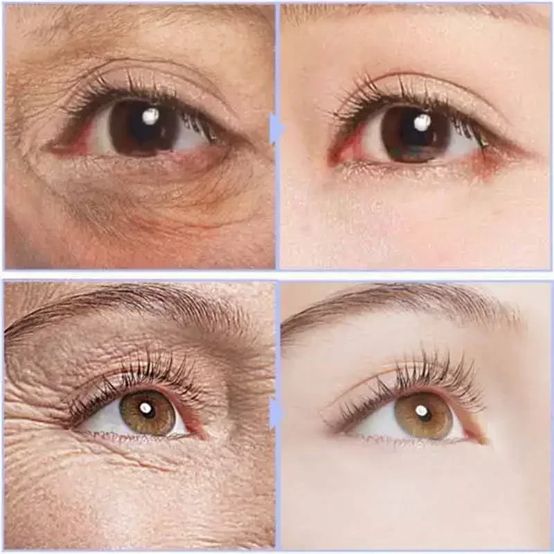 Crème contour des yeux effet tenseur 20 g – 3